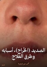 كتاب الصديد (الخراج)، أسبابه وطرق العلاج