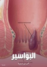 كتاب البواسير