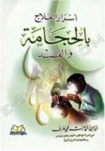 كتاب أسرار العلاج بالحجامة والفصد