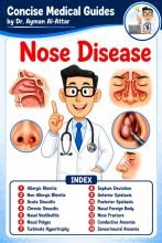 Nose Disease